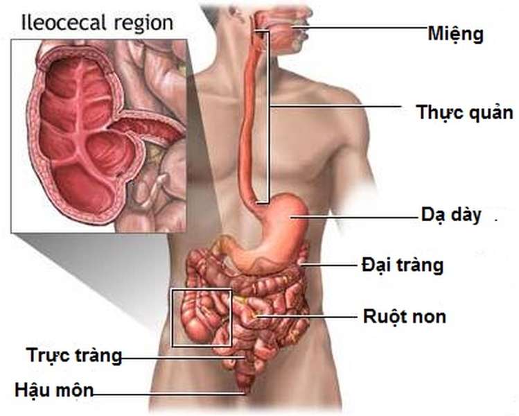 Bệnh Crohn: Nguyên nhân, biến chứng và cách điều trị